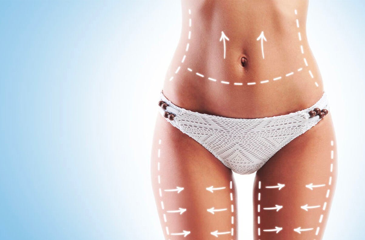 Come prevenire le smagliature quando fai sport - fgm04