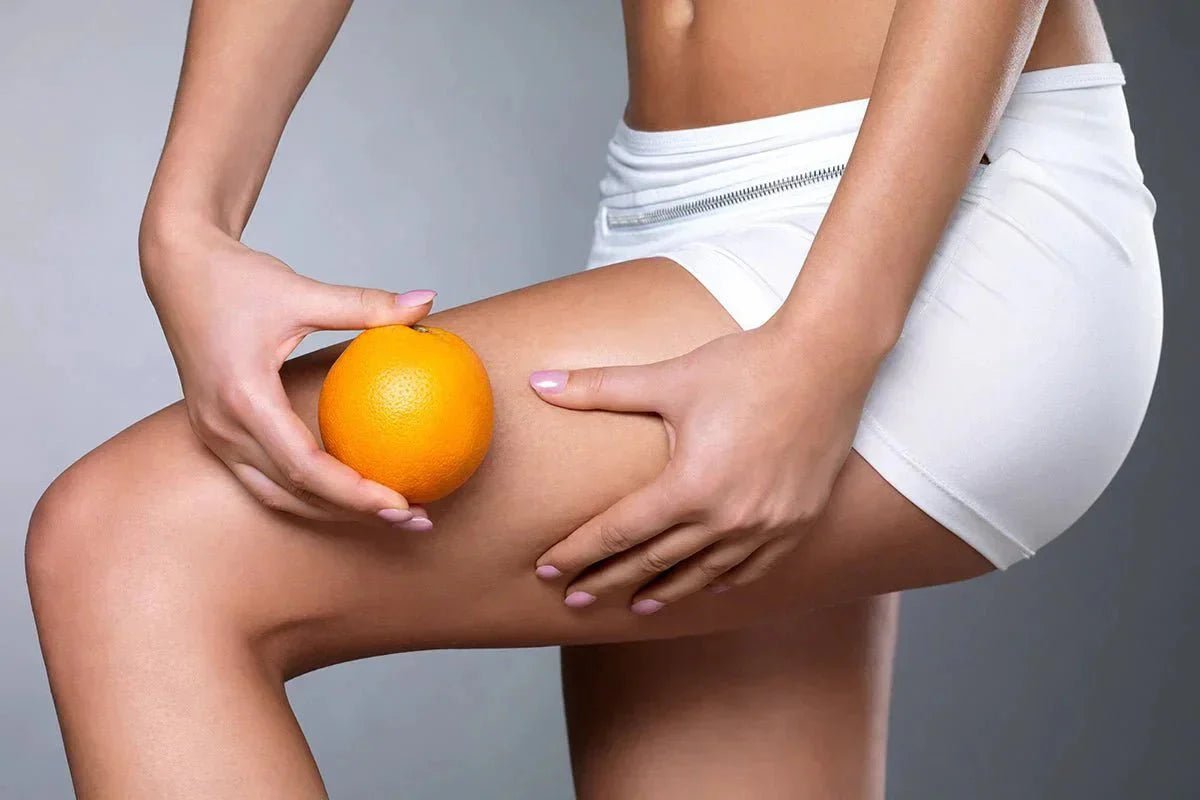 Come ridurre la cellulite? Programma efficace anticellulite - fgm04