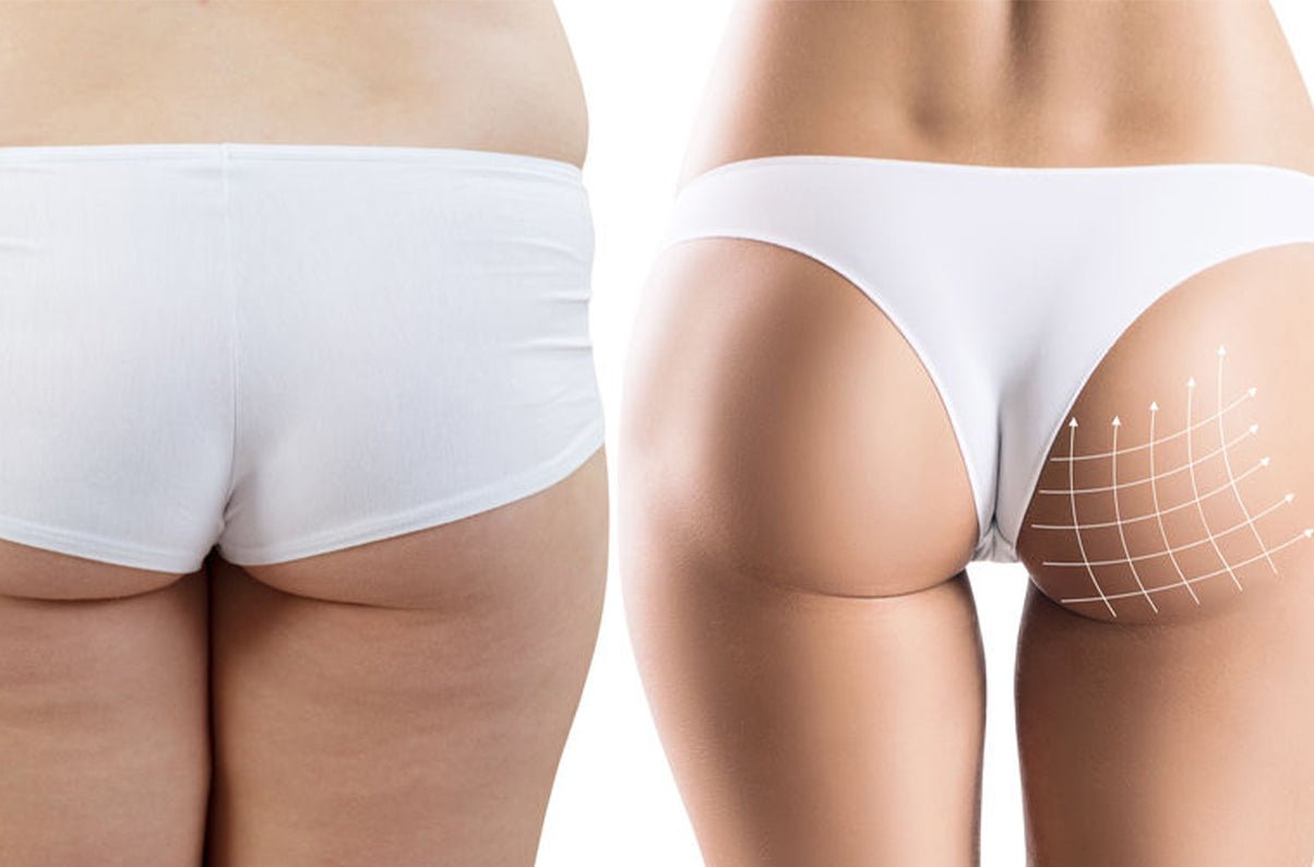 Esercizi per Rassodare Glutei e Cosce in una Settimana Velocemente - fgm04