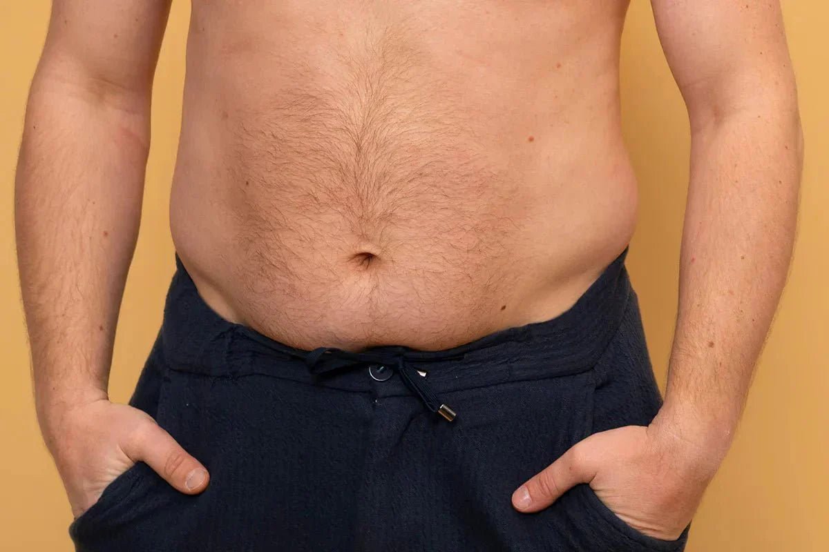 Come Togliere e Perdere la Pancia per un Uomo? - fgm04